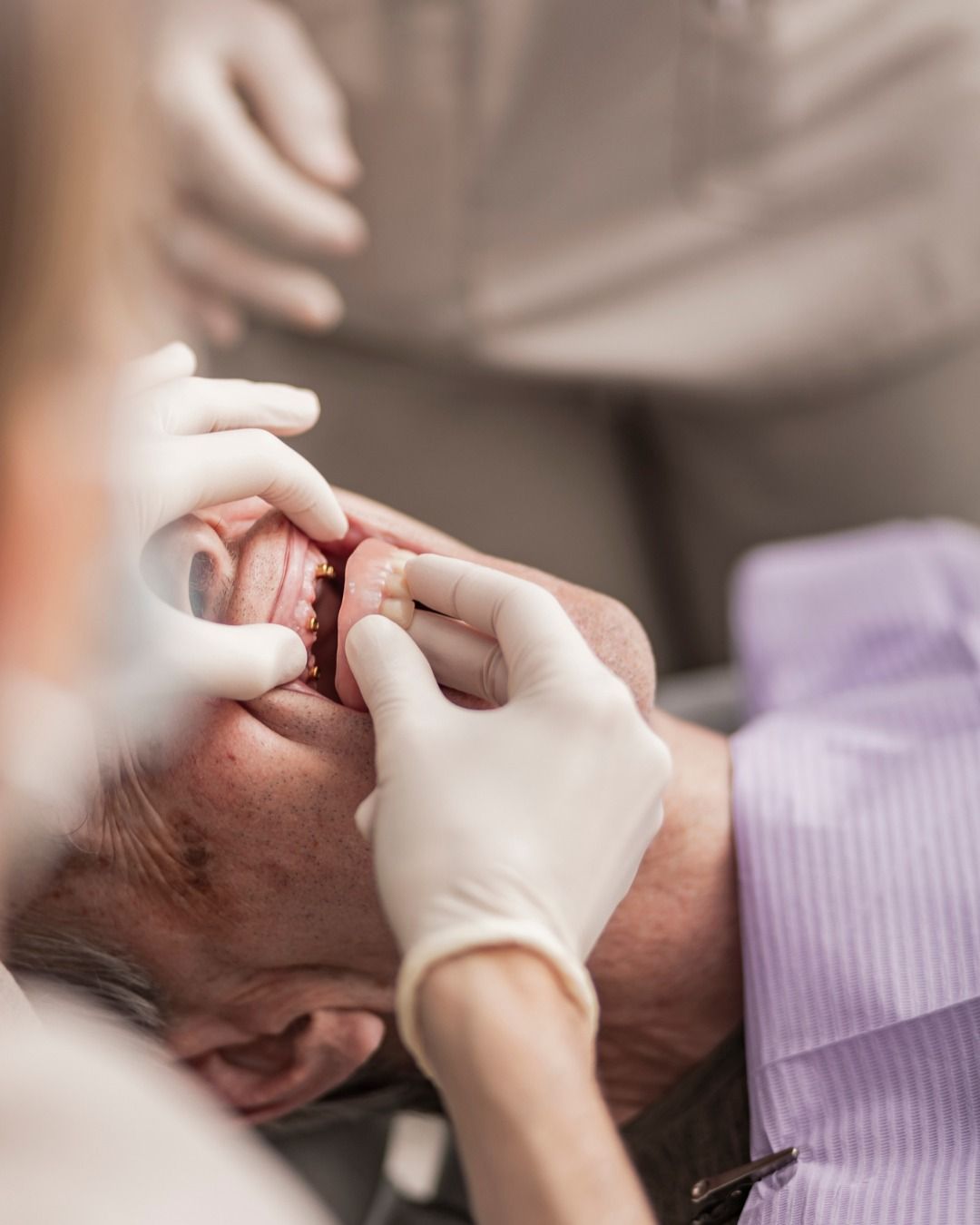 Dental Implants